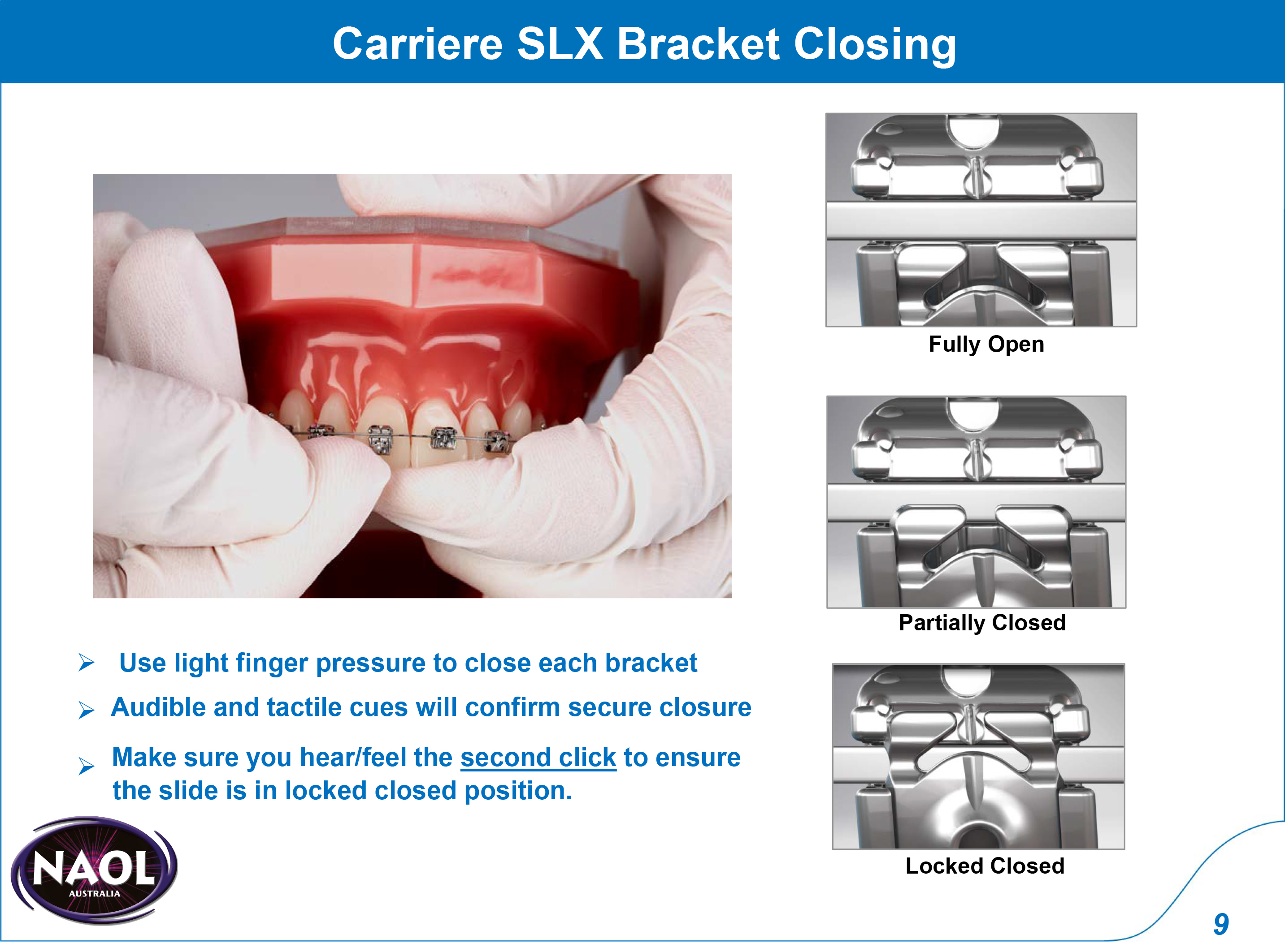 022 CARRIERE SLX MBT UL BICUSPID WITH HOOKS -7T (10)